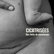 Cicatrisées