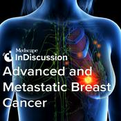 Medscape InDiscussion: Advanced and Metastatic Breast Cancer