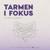 Tarmen i Fokus - Crohns sygdom